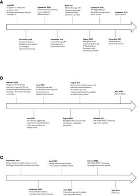 Case Report: 18F-PSMA PET/CT Scan in Castration Resistant Prostate Cancer With Aggressive Neuroendocrine Differentiation